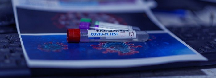 Число заразившихся коронавирусом на Чаянде может достичь тысячи человек